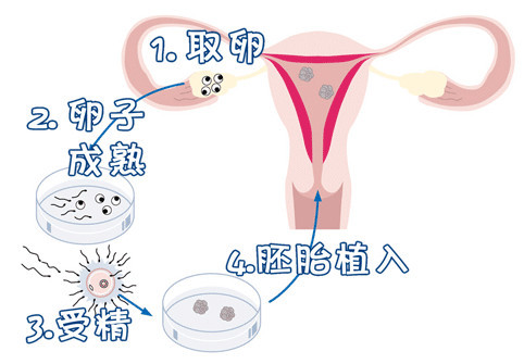 孕妇顺产