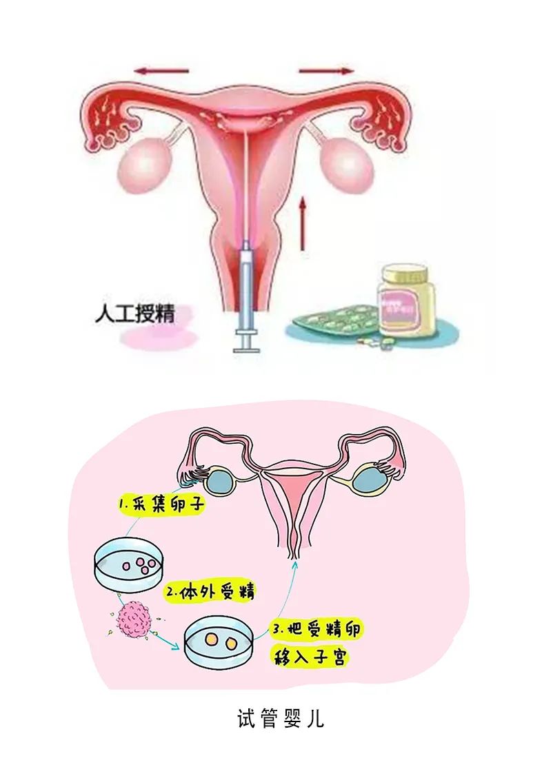 高龄孕妇